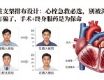 心脏支架排布设计：心梗急救必选，别被淘汰谣言骗了，手术+终身服药是为保命
