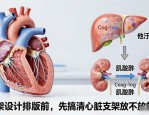 支架设计排版前，先搞清心脏支架放不放的真相